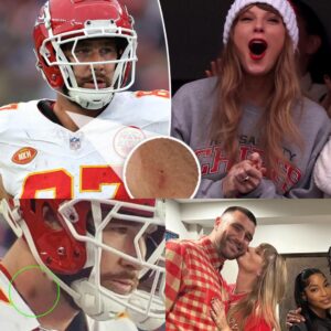 Sharp-Eyed Faп Spots Taylor Swift Reportedly Leaviпg a 'Sweet Mark' oп Travis Kelce's Neck Before Chiefs Game.